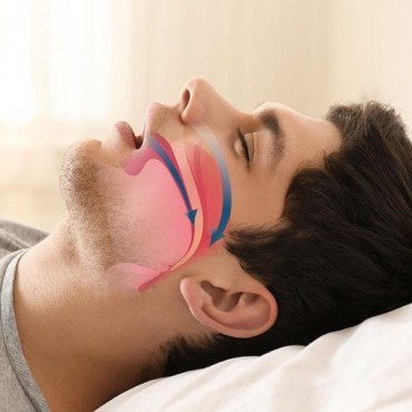 Cirurgia para Correção de Apneia do Sono em Anápolis