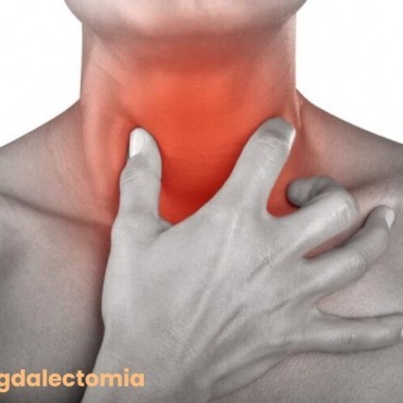 Amigdalectomia em Águas Lindas de Goiás