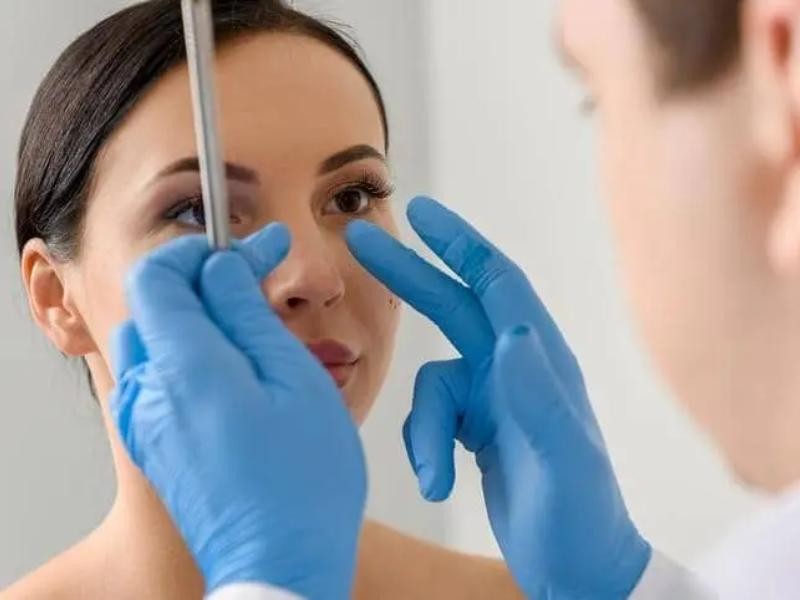Rinosseptoplastia funcional
